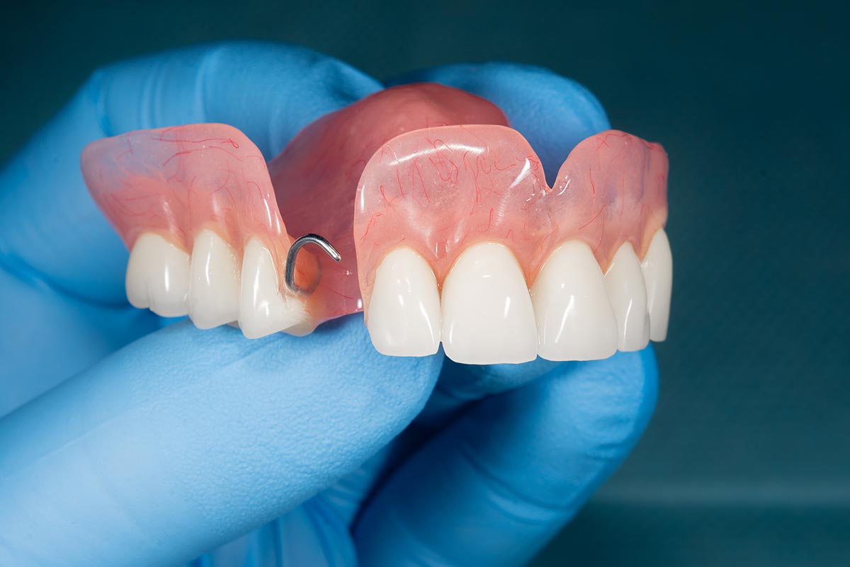 MS-Prosthetics-03