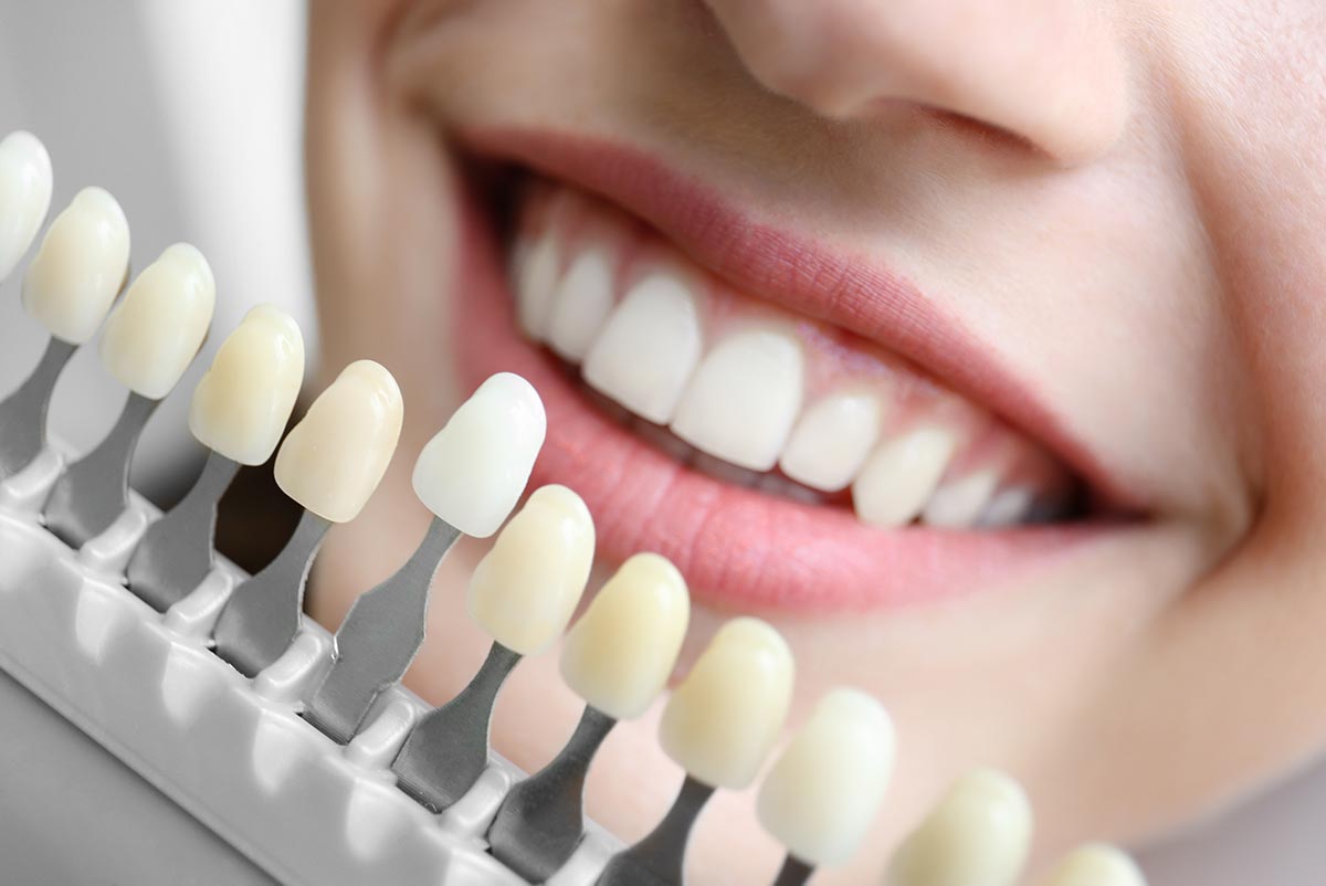 MS-Whitening-02