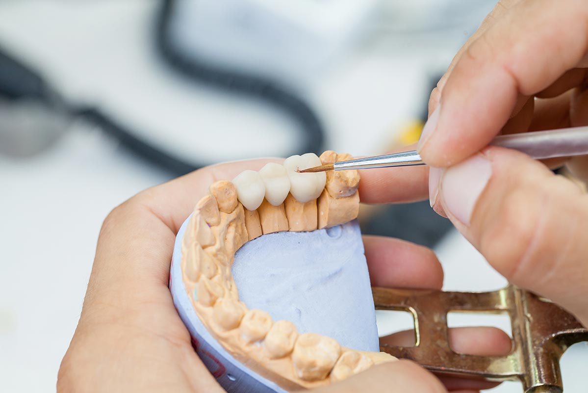 MS-Prosthetics-05